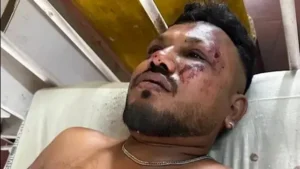 الناجي الوحيد من الطائرة الهندية المنكوبة يكشف تفاصيل ما حدث 2 الناجي الوحيد