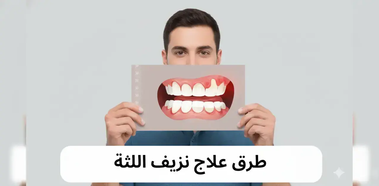 علاج نزيف اللثة: الأسباب والأعراض وأفضل طرق العلاج والوقاية