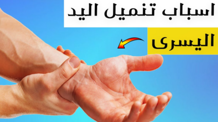 لماذا يحدث تنميل في اليد اليسرى