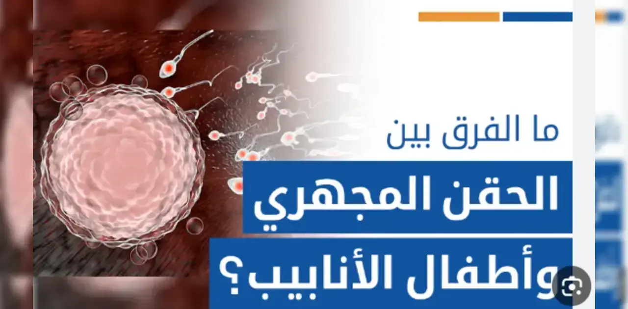 اكتشف الفرق بين الحقن المجهري وأطفال الأنابيب. دليل تفصيلي حول الخطوات،