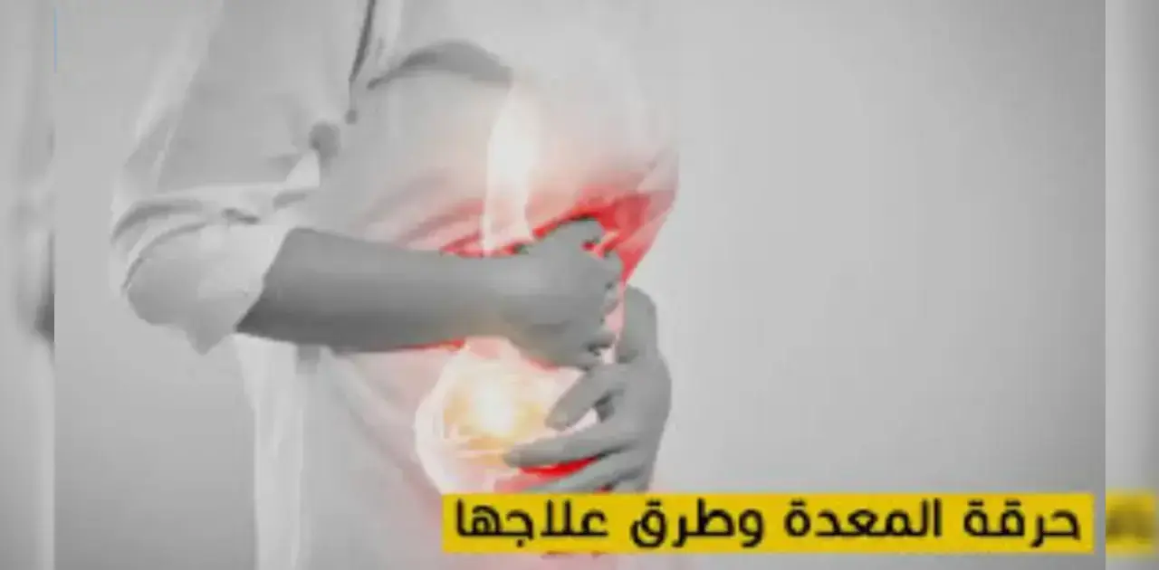 حرقة المعدة الحل؟ الدليل الكامل للراحة