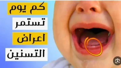 ما هي أبرز أعراض التسنين عند الأطفال؟